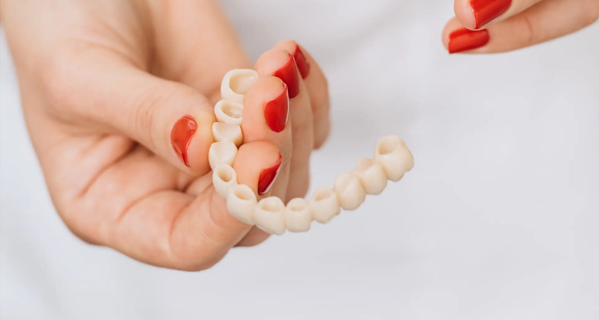 Zahnbrücken - Zubni mostovi | Štimac centar dentalne medicine