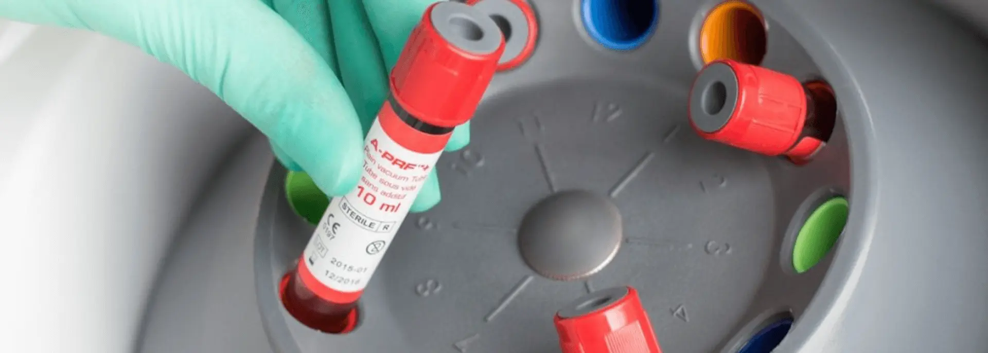 PRF Protokoll - PRF protokol | Štimac centar dentalne medicine