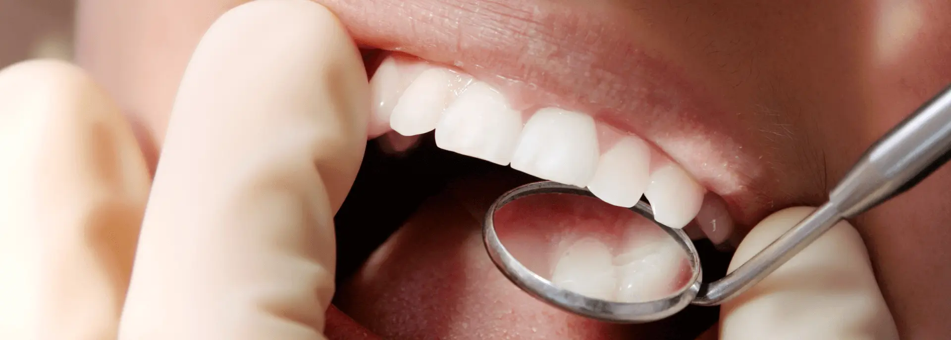 Zahnfüllungen - Ispuni | Štimac centar dentalne medicine