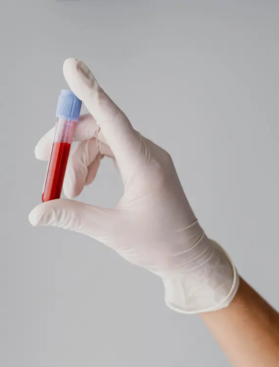 PRF Protokoll | PRF protocol | PRF protokol | Štimac centar dentalne medicine