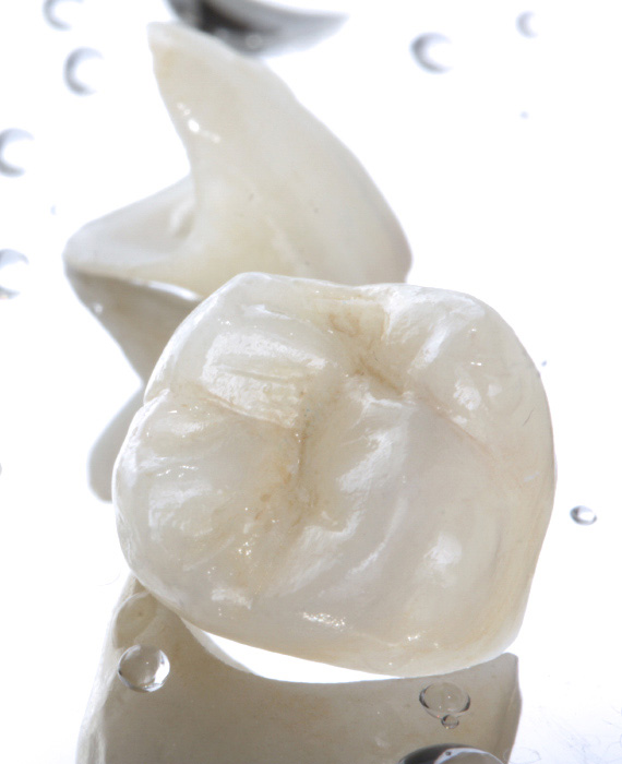 Zahnkronen | Dental crowns | KAJ SO ZOBNE KRONE?