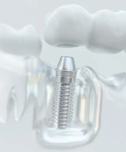 Dienstleistungen | Services | Stomatološke usluge | Štimac centar dentalne medicine