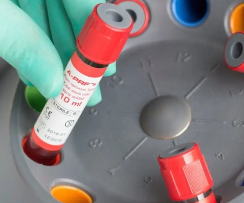 Oralchirurgie | PRF PROTOKOL