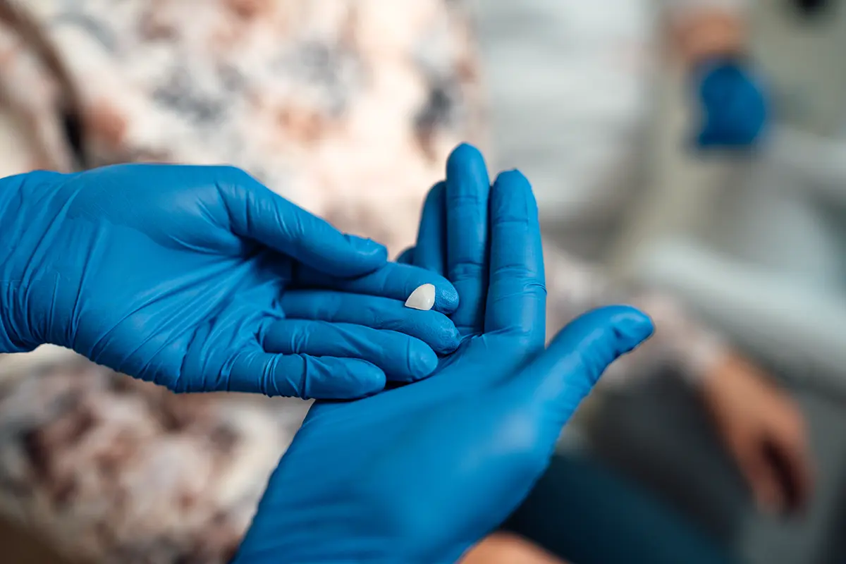 Yes, there are actually antiaging smile treatments! | Stomatološka poliklinika Zagreb | Štimac centar dentalne medicine