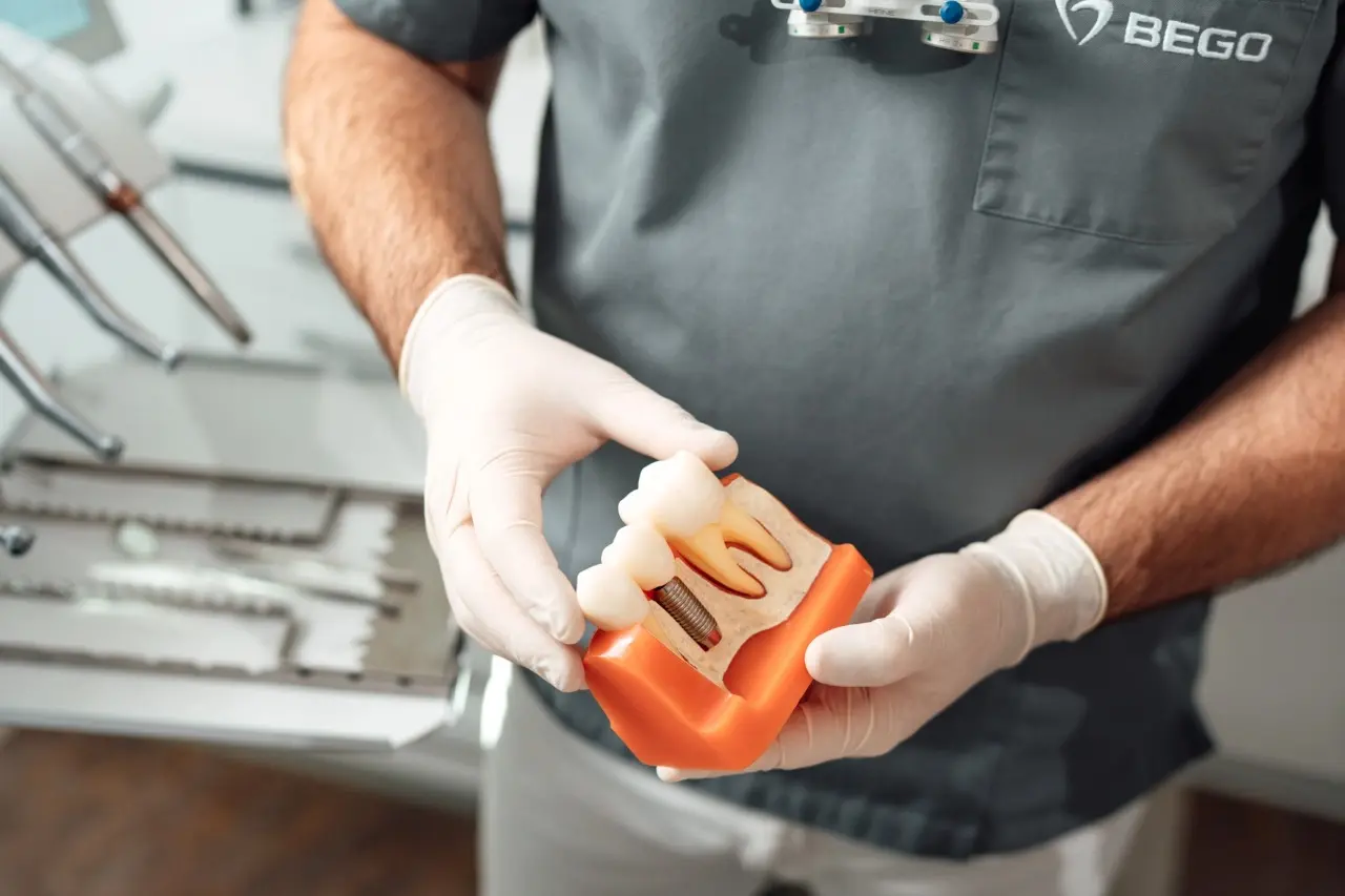 Let’s bust some common misconceptions about dental implants together | Stomatološka poliklinika Zagreb | Štimac centar dentalne medicine