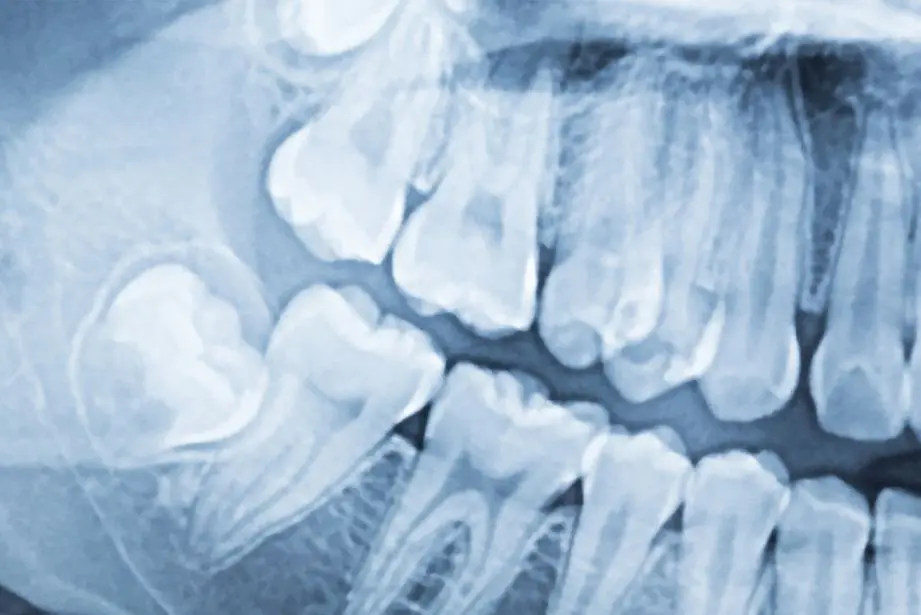 Precise Diagnostics in the Clinic Are the Guarantee of Successful Therapy | Precizna dijagnostika u ordinaciji garancija je uspješnosti vaše terapije | Stomatološka poliklinika Zagreb | Štimac centar dentalne medicine