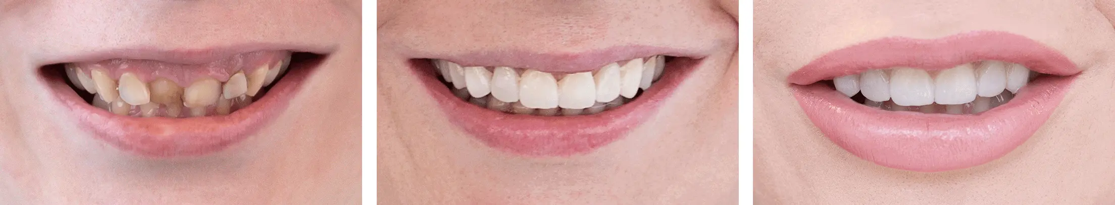 Mission: A Hollywood Smile | Misija: hollywoodski osmijeh - Stomatološka poliklinika | Misija: hollywoodski osmijeh | Stomatološka poliklinika Zagreb | Štimac centar dentalne medicine