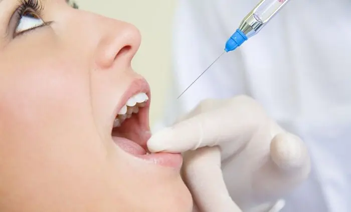 Everything You Need to Know About Tooth Extraction | Vađenje zuba | Štimac Centar dentalne medicine | Vađenje zuba | Stomatološka poliklinika Zagreb | Štimac centar dentalne medicine