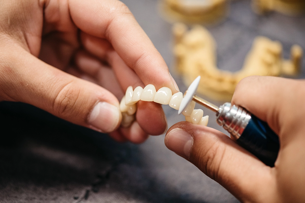 Everything You Wanted to Know About Dental Crowns and Bridges | Sve što ste htjeli znati o zubnim krunicama i mostovima | Stomatološka poliklinika Zagreb | Štimac centar dentalne medicine