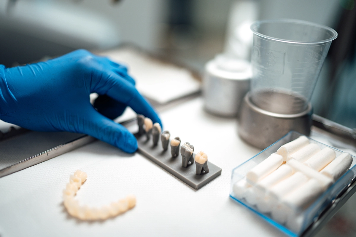 Everything You Wanted to Know About Dental Crowns and Bridges | Sve što ste htjeli znati o zubnim krunicama i mostovima | Stomatološka poliklinika Zagreb | Štimac centar dentalne medicine