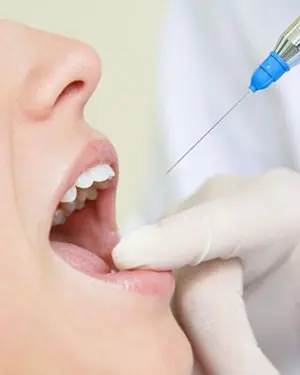 Everything You Need to Know About Tooth Extraction - Vađenje zuba | Štimac centar dentalne medicine