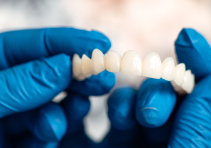 Everything You Wanted to Know About Dental Crowns and Bridges - Stomatološka poliklinika Zagreb | Štimac centar dentalne medicine