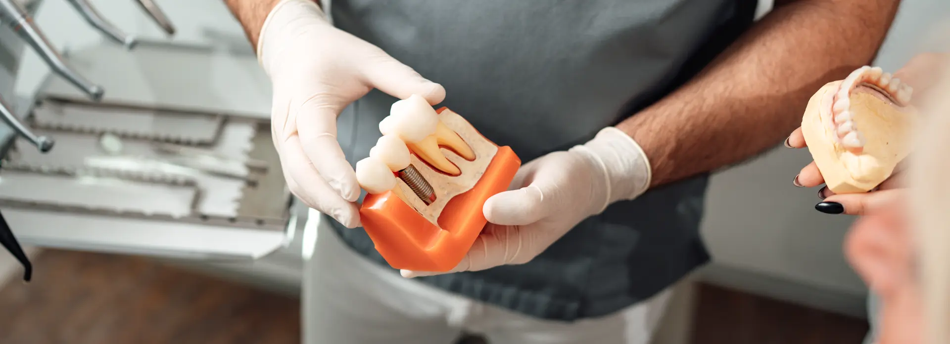 Everything You Need to Know About Dental Implant Placement: Answers to Your Questions - Stomatološka poliklinika Zagreb | Štimac centar dentalne medicine