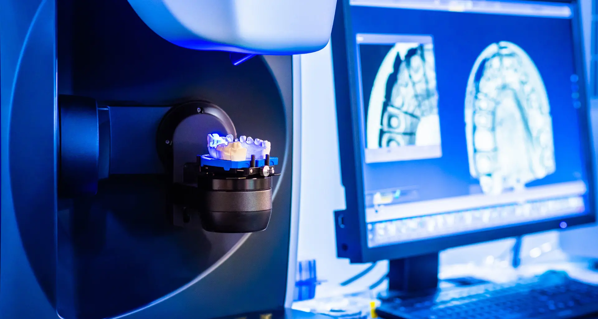 CAD-CAM Technology - CAD-CAM tehnologija | Štimac centar dentalne medicine