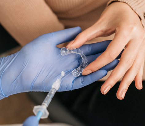 Teeth whitening | IZBJELJIVANJE UDLAGAMA