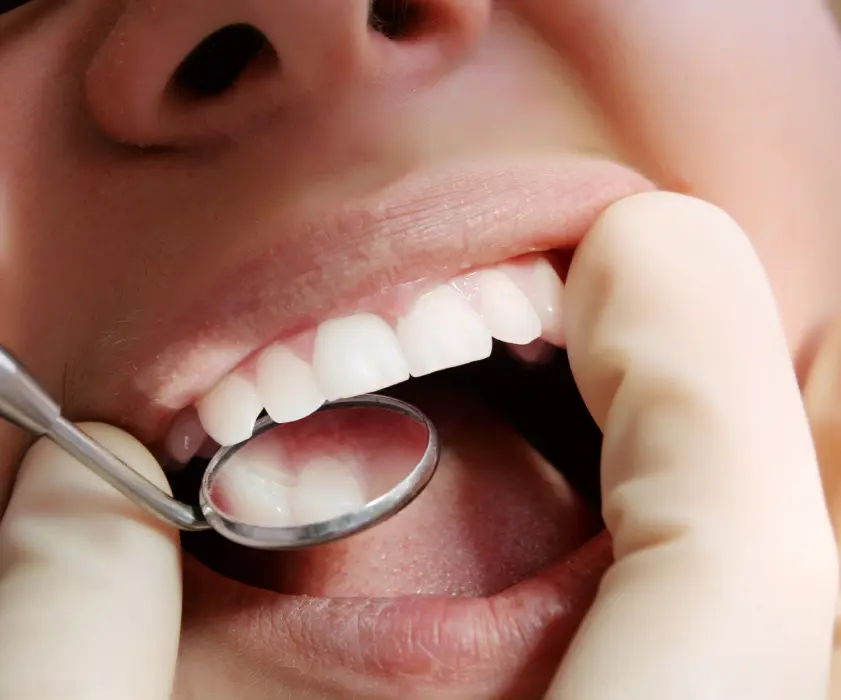 General dentistry | ISPUNI