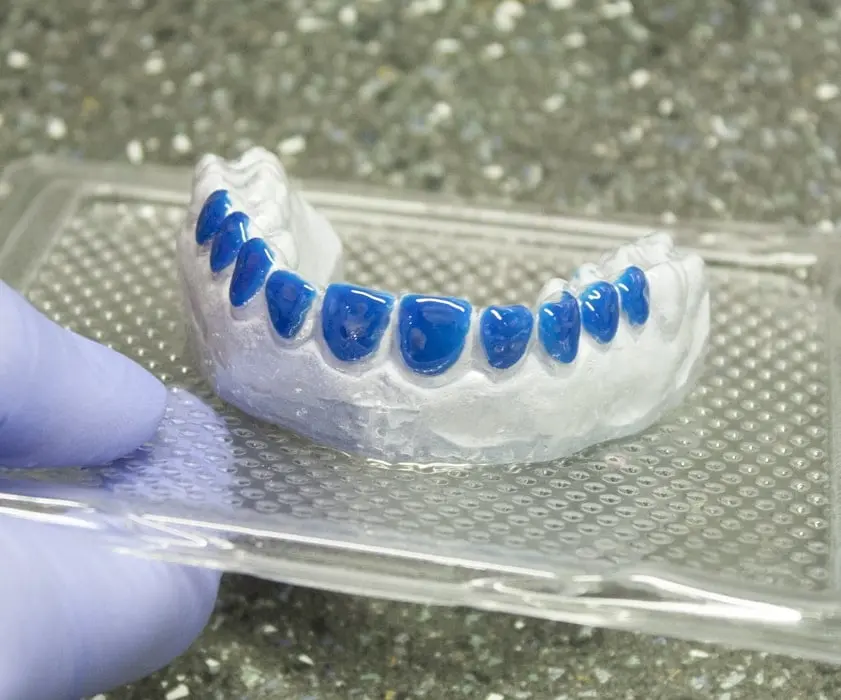 Teeth whitening | IZBJELJIVANJE UDLAGAMA