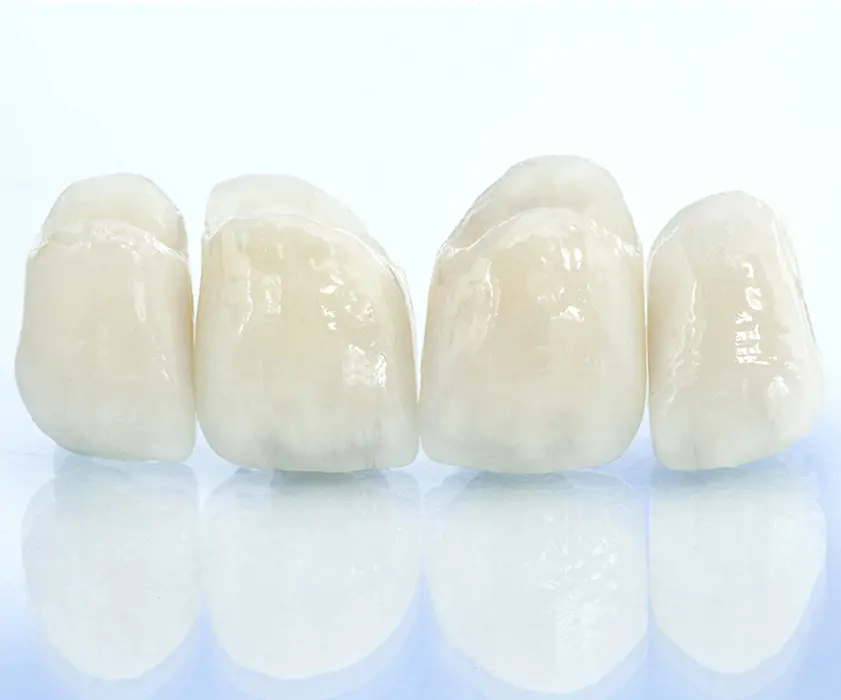 Dental prosthetics | ZUBNE KRUNICE