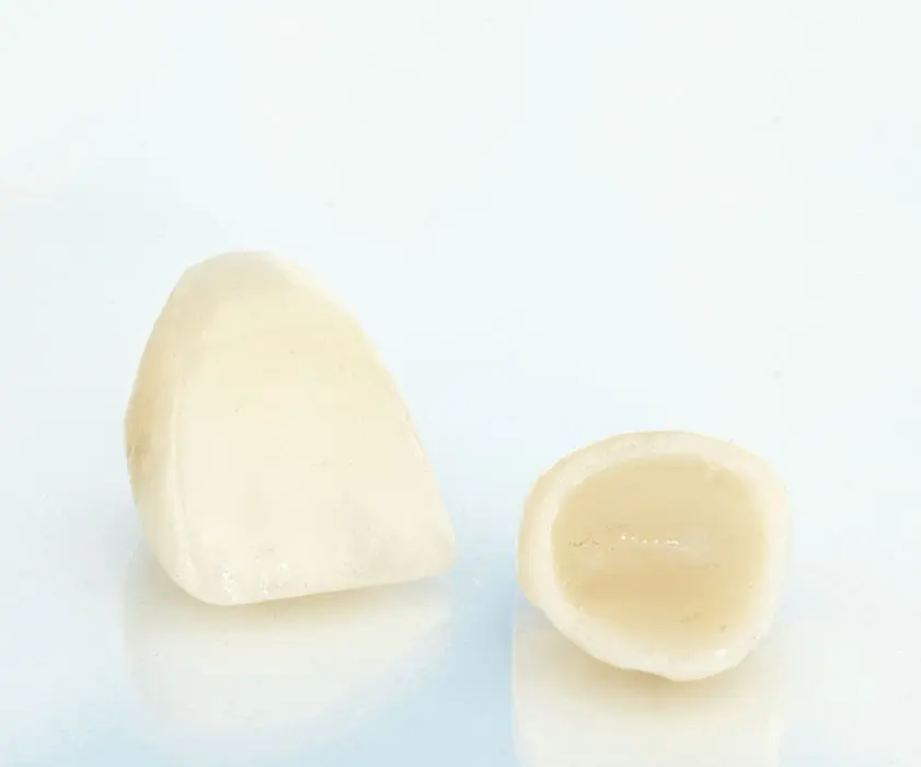 Dental crowns | POTPUNO KERAMIČKA ZUBNA KRUNICA