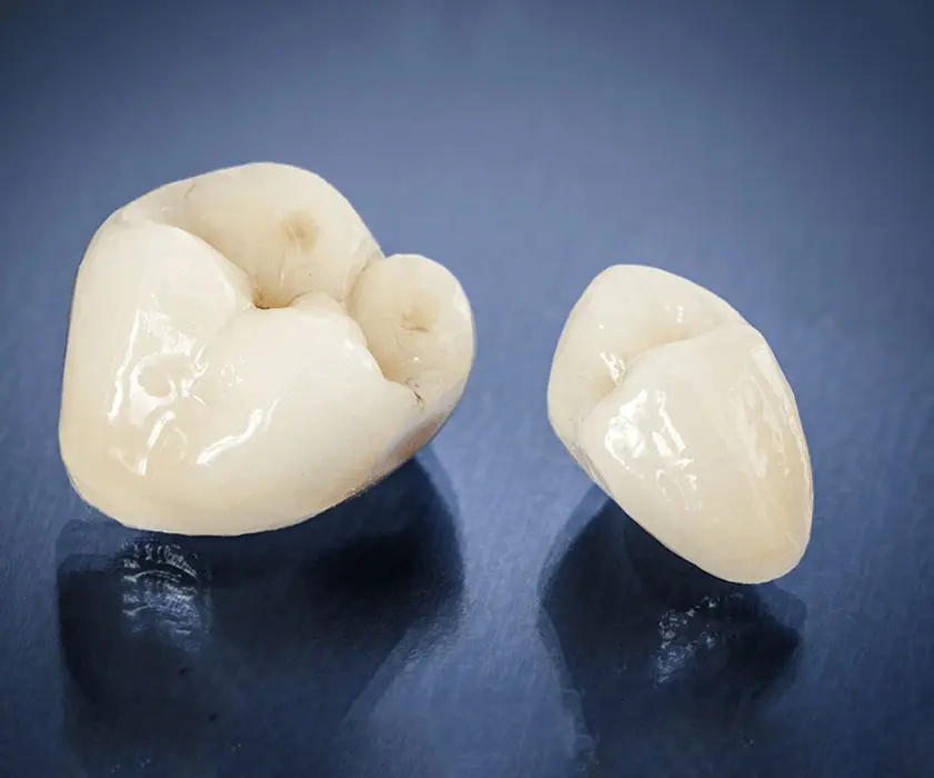 Dental laboratory | ZUBNE KRUNICE