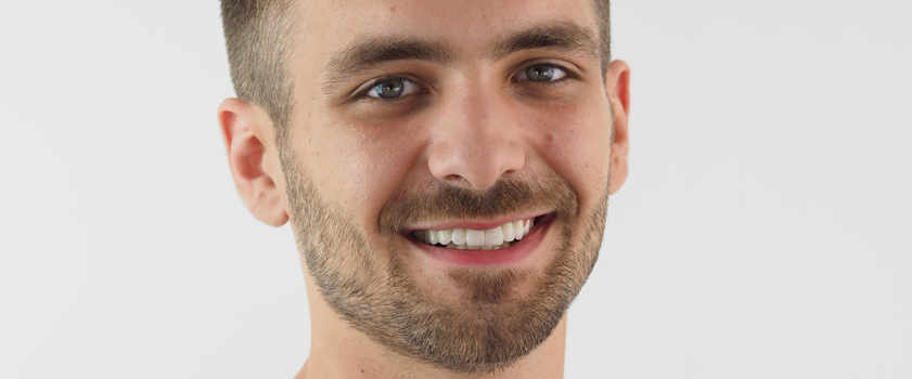 Dental makeover | IMPLANTATI