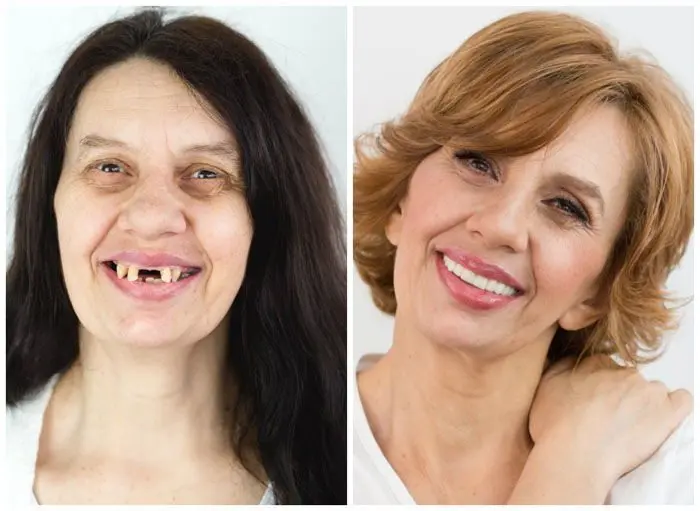 Humanitarni makeover - Blog | Štimac Centar dentalne medicine | Humanitarni makeover | Stomatološka poliklinika Zagreb | Štimac centar dentalne medicine