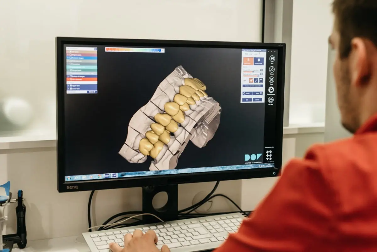 Zaboravite na neugodno uzimanje otisaka zubi | drstimac.com | Zaboravite na neugodno uzimanje otisaka kod stomatologa | Stomatološka poliklinika Zagreb | Štimac centar dentalne medicine