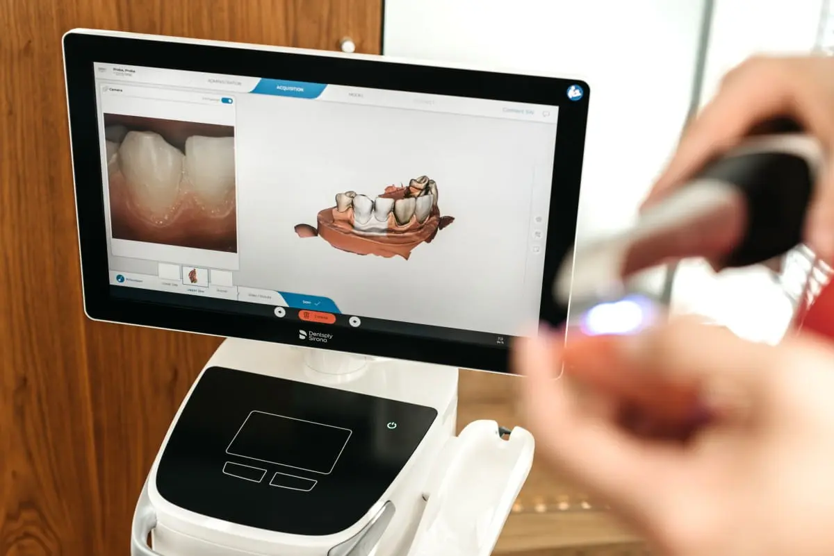 Zaboravite na neugodno uzimanje otisaka zubi | drstimac.com | Zaboravite na neugodno uzimanje otisaka kod stomatologa | Stomatološka poliklinika Zagreb | Štimac centar dentalne medicine