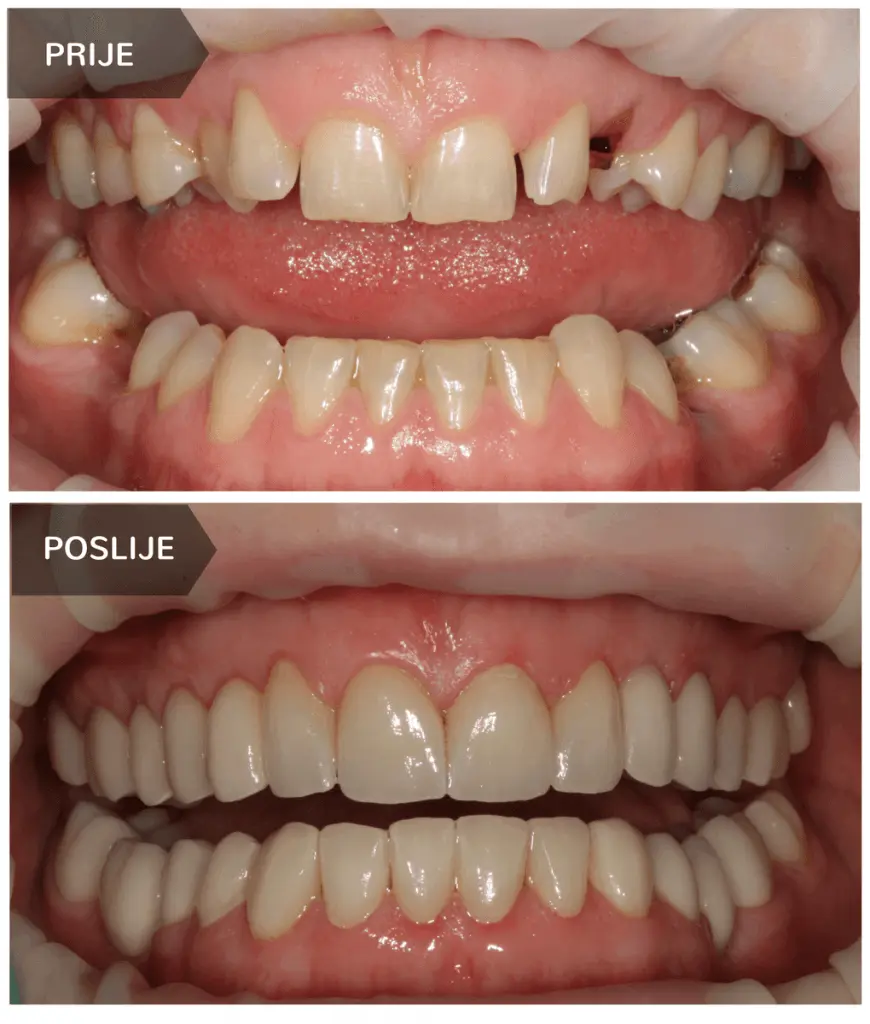 Vrhunske usluge estetske stomatologije u Štimac centru | drstimac.com | Vrhunske usluge estetske stomatologije u Štimac centru | Stomatološka poliklinika Zagreb | Štimac centar dentalne medicine