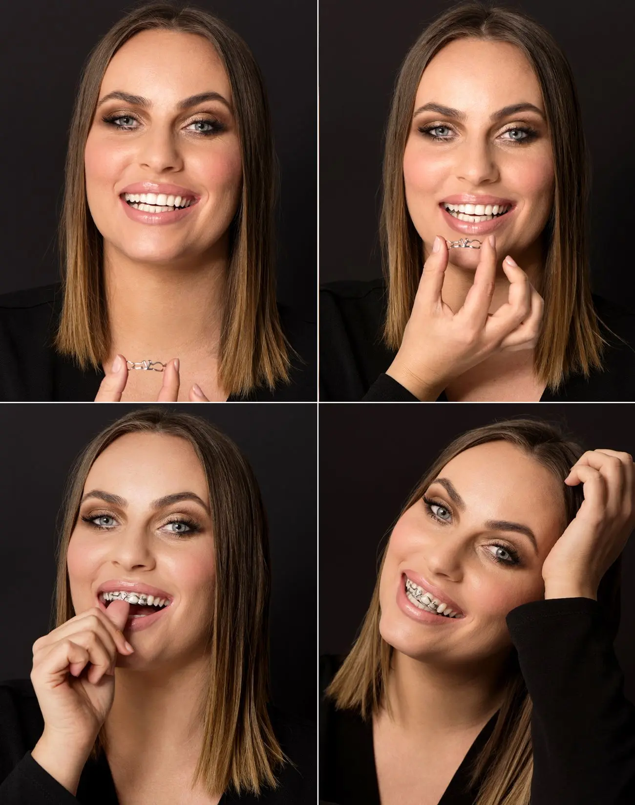 Novost u našem centru - zubni nakit za odvažne! | Novost u našem centru – zubni nakit za odvažne! | Stomatološka poliklinika Zagreb | Štimac centar dentalne medicine