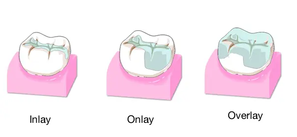 Vrhunske usluge estetske stomatologije u Štimac centru | drstimac.com | Vrhunske usluge estetske stomatologije u Štimac centru | Stomatološka poliklinika Zagreb | Štimac centar dentalne medicine