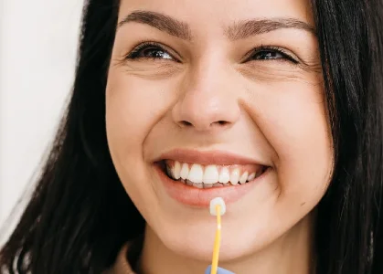 Sve što trebate znati o zubnim ljuskicama: odgovori na najtraženija pitanja - Stomatološka poliklinika Zagreb | Štimac centar dentalne medicine