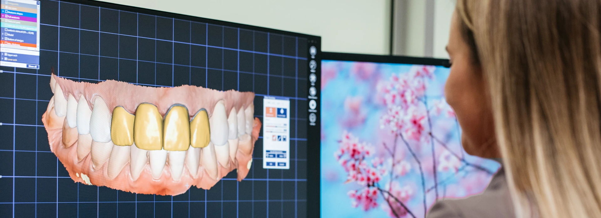 Digital Smile Design: kako nastaje savršen osmijeh - Stomatološka poliklinika Zagreb | Štimac centar dentalne medicine