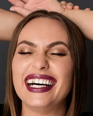 Novost u našem centru – zubni nakit za odvažne! - Grillz zubni nakit za odvažne | Štimac centar dentalne medicine