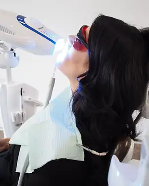 Izbjeljivanje zuba u Štimac poliklinici u Zagrebu - Izbjeljivanje zuba u Štimac poliklinici u Zagrebu | Štimac centar dentalne medicine