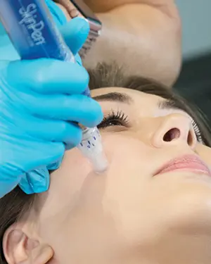 SkinPen tretman – sve što treba vašoj koži za sjaj i mladolik izgled - SkinPen tretman za sjaj i mladolik izgled | Štimac centar dentalne medicine