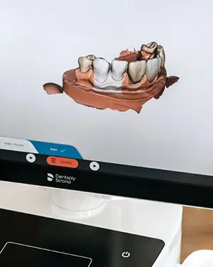 Jaki brandovi su bitni – i kad su zubi u pitanju - Duga suradnja s provjerenim proizvođačima materijala | Štimac centar dentalne medicine