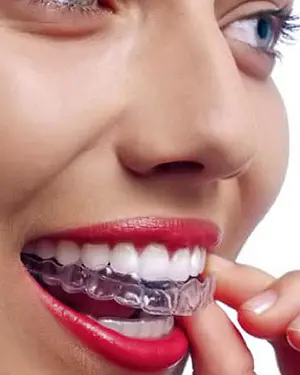 Imate problema sa škrgutanjem ili stiskanjem zubi tokom noći? - Imate problema sa škrgutanjem ili stiskanjem zubi tokom noći | Štimac centar dentalne medicine