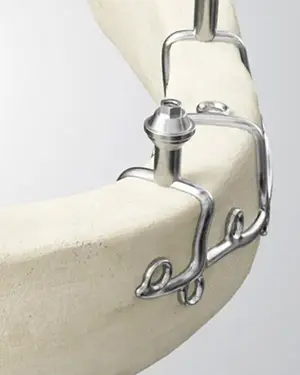 Revolucionarno rješenje za sve koji dosad nisu mogli dobiti implantate - Zero Bone Implant | Štimac centar dentalne medicine