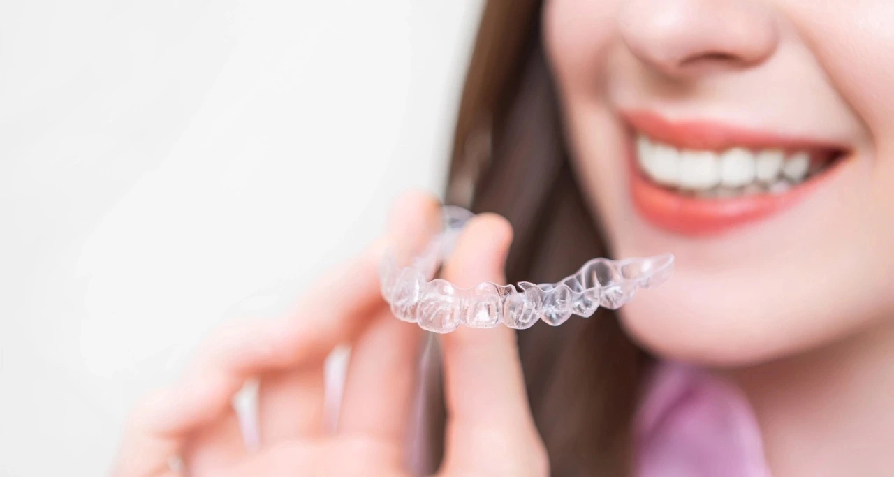 Ortodontska terapija - Što je ortodonska terapija | Štimac centar dentalne medicine