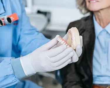 All on 4 metoda - All on 4 metoda | Štimac centar dentalne medicine