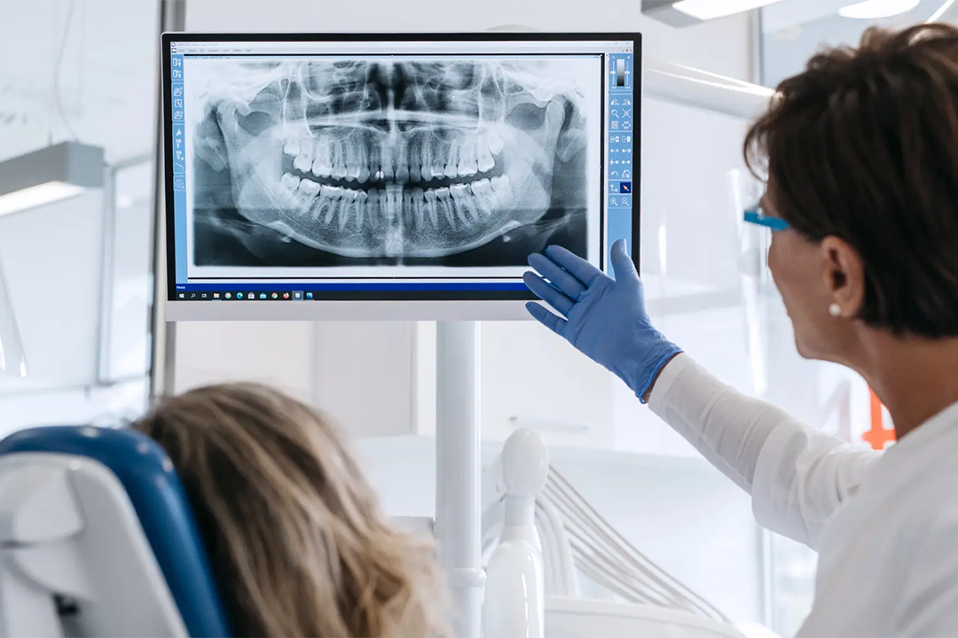 Rendgenska dijagnostika - Rendgenska dijagnostika | Štimac centar dentalne medicine