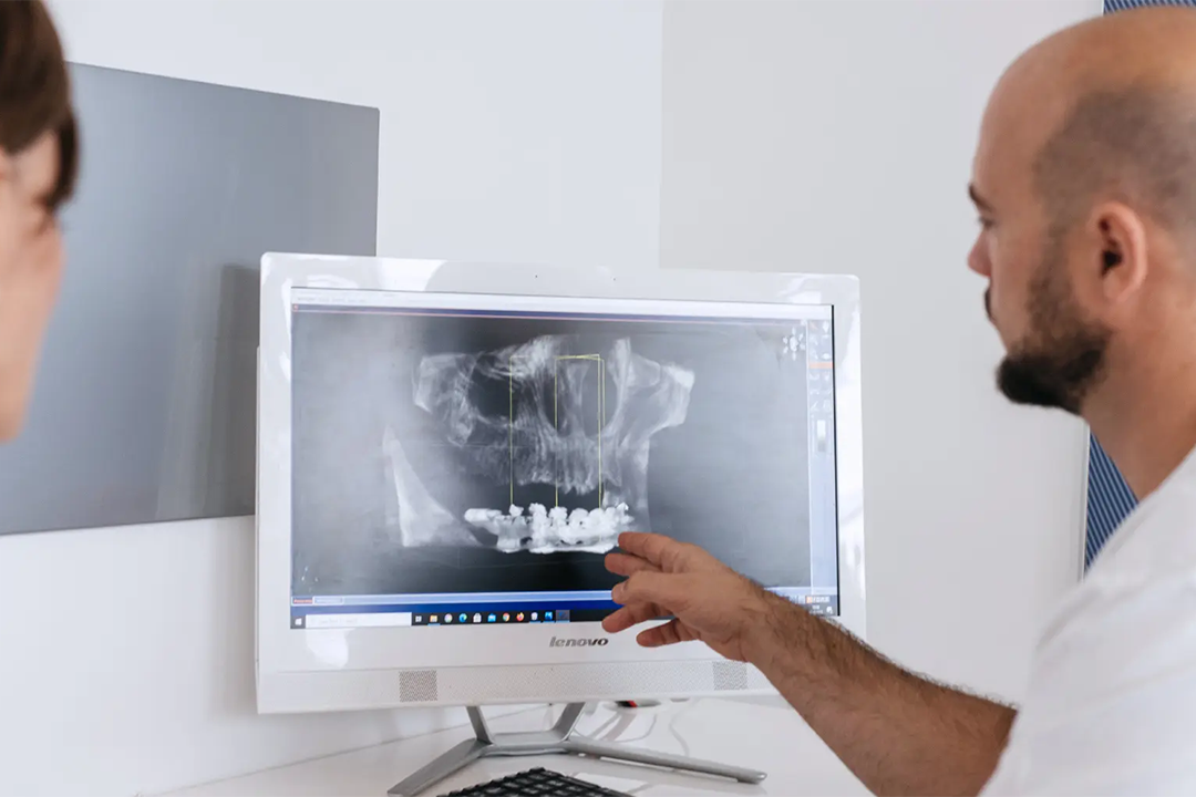 Sinus lift i ugradnja umjetne kosti - Filip Štimac dr. med. dent, spec. oralne kirurgije | Sinus lift i ugradnja umjetne kosti