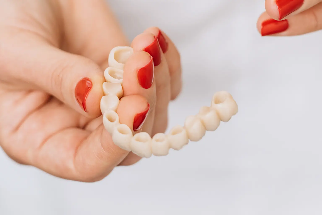 Zubni mostovi - Zubni mostovi | Štimac centar dentalne medicine