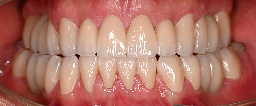 O nama - Prije i poslije | Štimac Centar dentalne medicine | Studije slučaja novo | Štimac Centar dentalne medicine | Studije slučaja