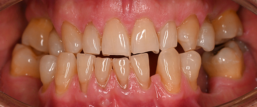 O nama - Prije i poslije | Štimac Centar dentalne medicine | Studije slučaja novo | Štimac Centar dentalne medicine | Studije slučaja
