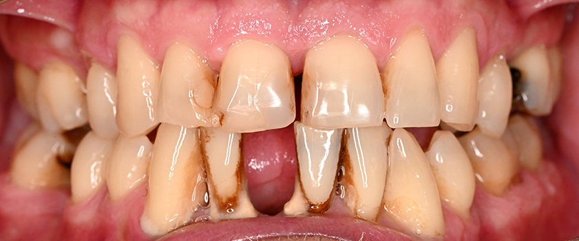 O nama - Prije i poslije | Štimac Centar dentalne medicine | Studije slučaja novo | Štimac Centar dentalne medicine | Studije slučaja