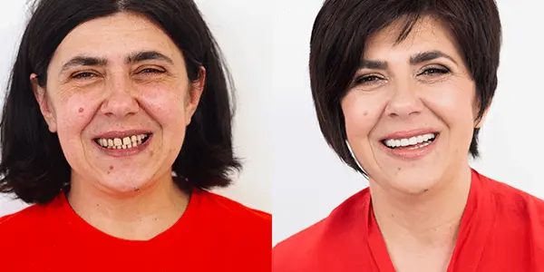 Makeover 2014 | Stomatološka poliklinika Štimac | Zagreb | Makeover 2014 | Stomatološka poliklinika Zagreb | Štimac centar dentalne medicine