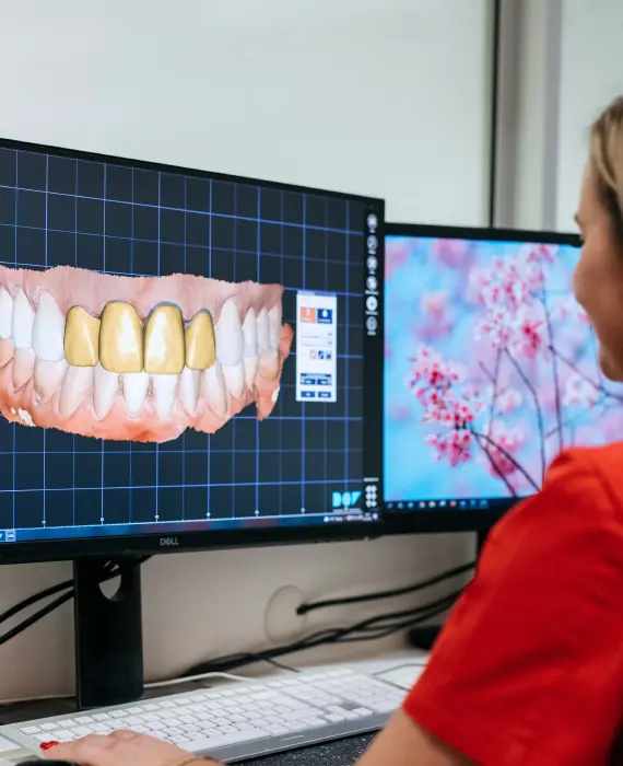 Zubotehnički laboratorij | Zagreb | Štimac centar dentalne medicine | Zubotehnički laboratorij Stomatološka poliklinika Zagreb | Štimac centar dentalne medicine