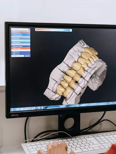 Tehnologija u dentalnom centru | Zagreb | Štimac centar | High-tech centar | Stomatološka poliklinika Zagreb | Štimac centar dentalne medicine